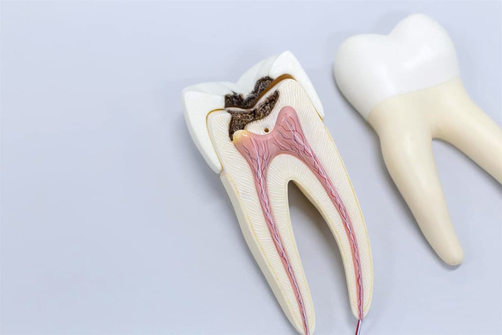 Especialistas en endodoncias en Monteporreiro