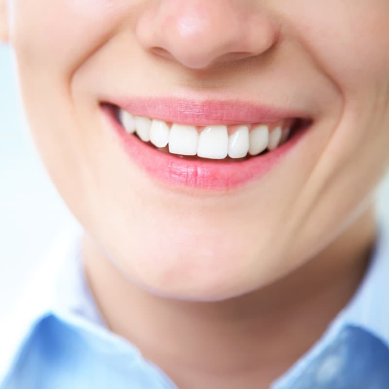 tratamientos estética dental en Pontevedra