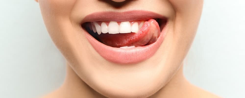 Blanqueamientos dentales