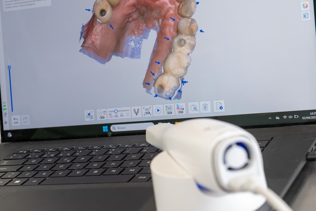 Escáner intraoral Medit i700