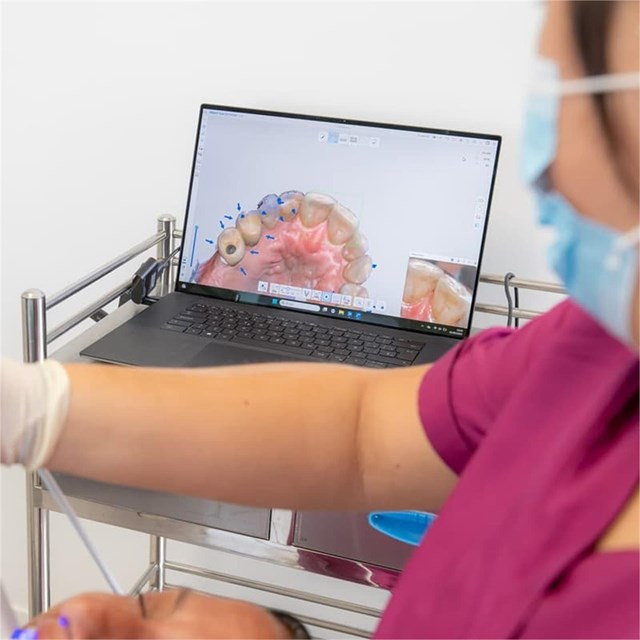 Resultados inmejorables en nuestros implantes